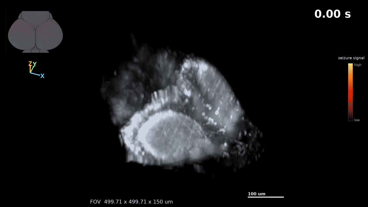 gif showing a zebrafish brain rotating with areas of orange lighting up and moving through it to represent seizure activity